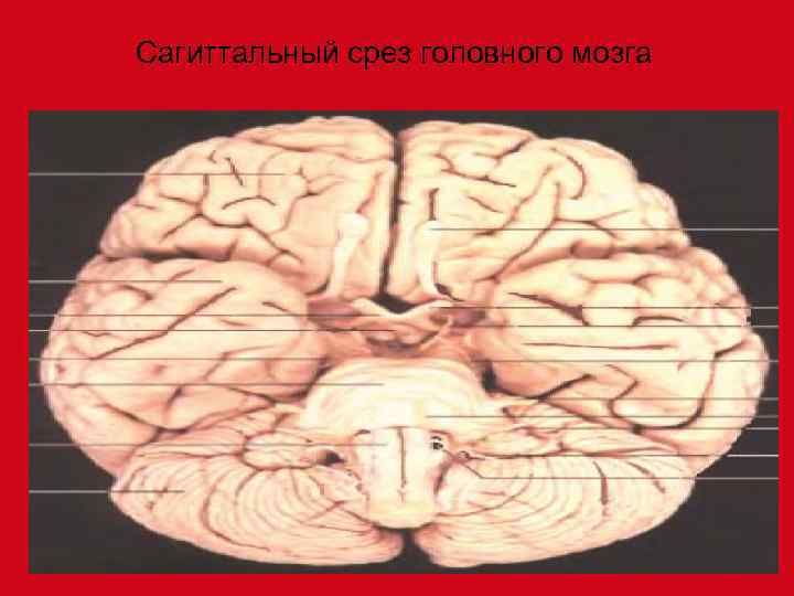 Сагиттальный срез головного мозга 