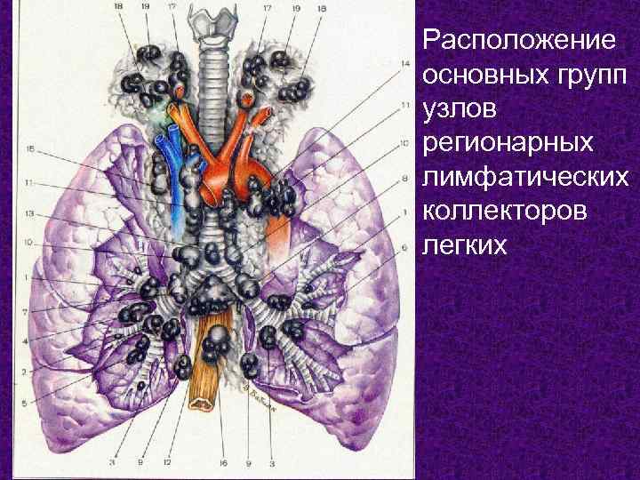 Расположение основных групп узлов регионарных лимфатических коллекторов легких 