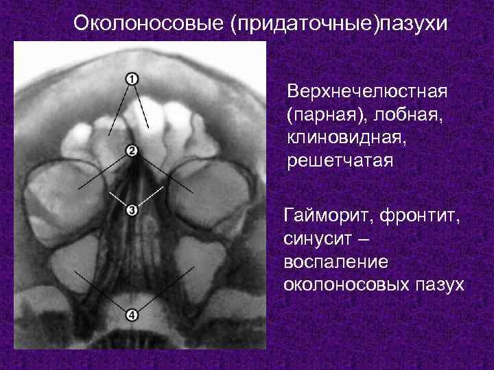 Околоносовые (придаточные)пазухи     Верхнечелюстная    (парная), лобная,  