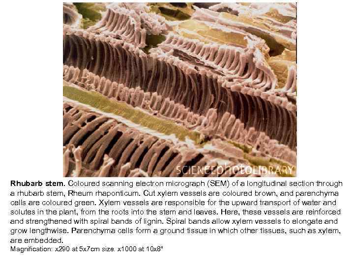 Rhubarb stem. Coloured scanning electron micrograph (SEM) of a longitudinal section through a rhubarb