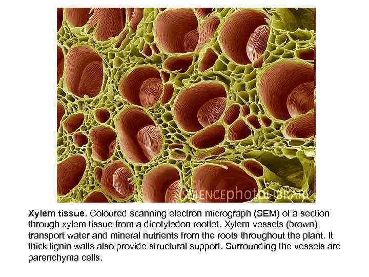 Xylem tissue. Coloured scanning electron micrograph (SEM) of a section through xylem tissue from