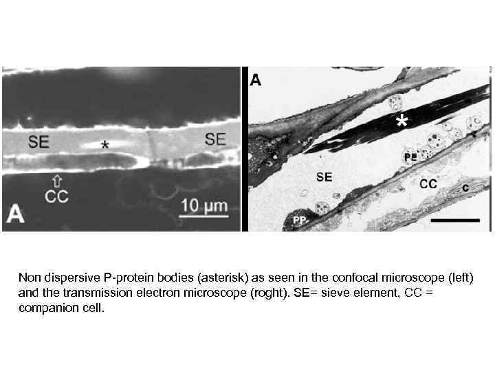 Non dispersive P-protein bodies (asterisk) as seen in the confocal microscope (left) and the