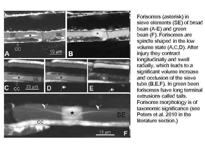 Forisomes (asterisk) in sieve elements (SE) of broad bean (A-E) and green bean (F).