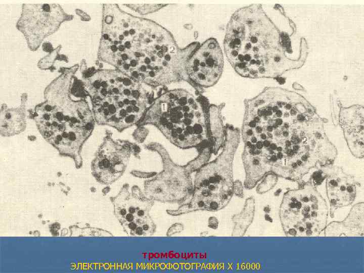 тромбоциты ЭЛЕКТРОННАЯ МИКРОФОТОГРАФИЯ X 16000 