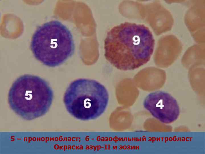 5 – пронормобласт; 6 - базофильный эритробласт Окраска азур-II и эозин 