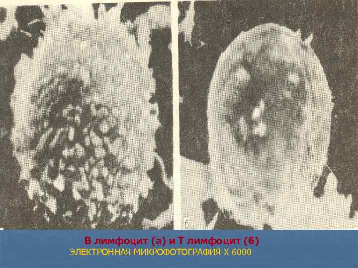 В лимфоцит (а) и Т лимфоцит (б) ЭЛЕКТРОННАЯ МИКРОФОТОГРАФИЯ X 6000 