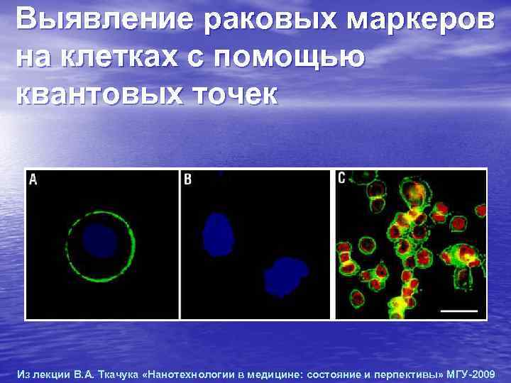 Выявление раковых маркеров на клетках с помощью квантовых точек Из лекции В. А. Ткачука Выявление раковых маркеров на клетках с помощью квантовых точек Из лекции В. А. Ткачука