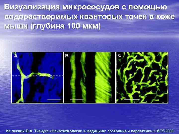 Визуализация микрососудов с помощью водорастворимых квантовых точек в коже мыши (глубина 100 мкм) Из Визуализация микрососудов с помощью водорастворимых квантовых точек в коже мыши (глубина 100 мкм) Из