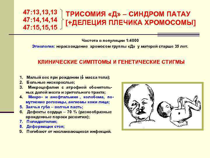  47: 13, 13  ТРИСОМИЯ «Д» – СИНДРОМ ПАТАУ 47: 14, 14 