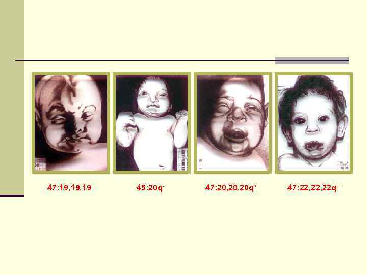 47: 19, 19  45: 20 q-  47: 20, 20 q+  47: