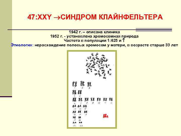   47: ХХY СИНДРОМ КЛАЙНФЕЛЬТЕРА     1942 г. – описана