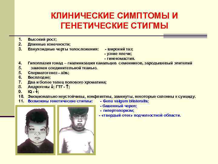     КЛИНИЧЕСКИЕ СИМПТОМЫ И   ГЕНЕТИЧЕСКИЕ СТИГМЫ 1.  Высокий