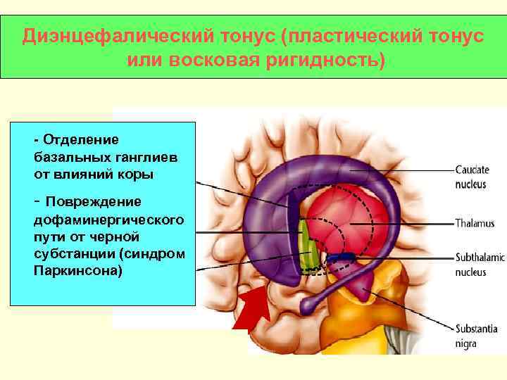 Диэнцефалический тонус (пластический тонус   или восковая ригидность)  - Отделение базальных ганглиев