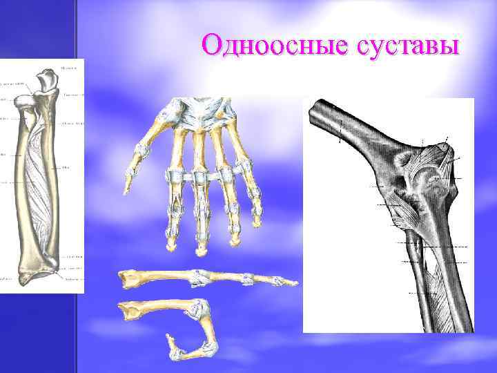 Одноосные суставы 