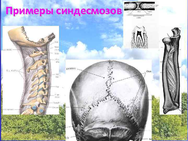 Примеры синдесмозов 