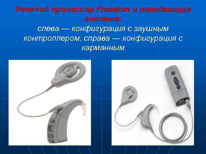 Речевой процессор Freedom и передающая   антенна:  слева — конфигурация с заушным