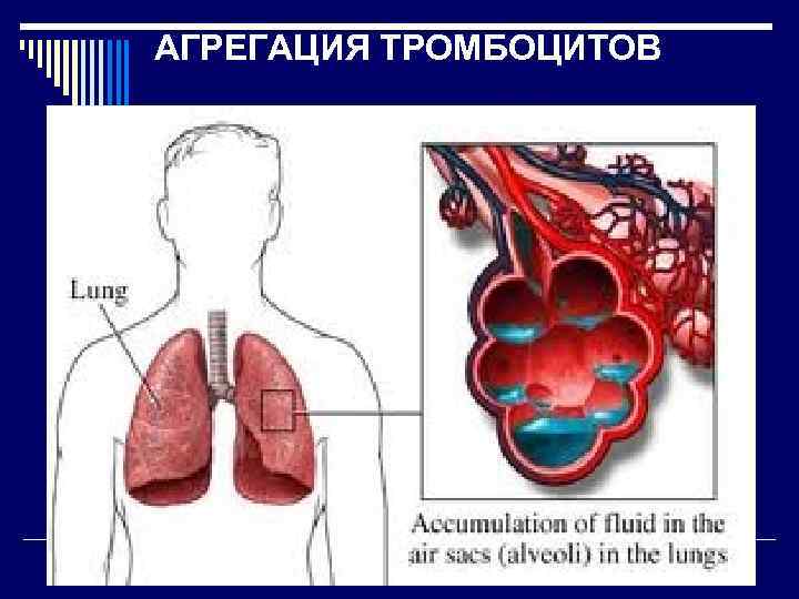 АГРЕГАЦИЯ ТРОМБОЦИТОВ 