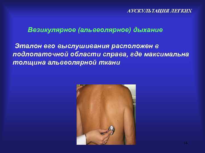      АУСКУЛЬТАЦИЯ ЛЕГКИХ Везикулярное (альвеолярное) дыхание Эталон его выслушивания расположен