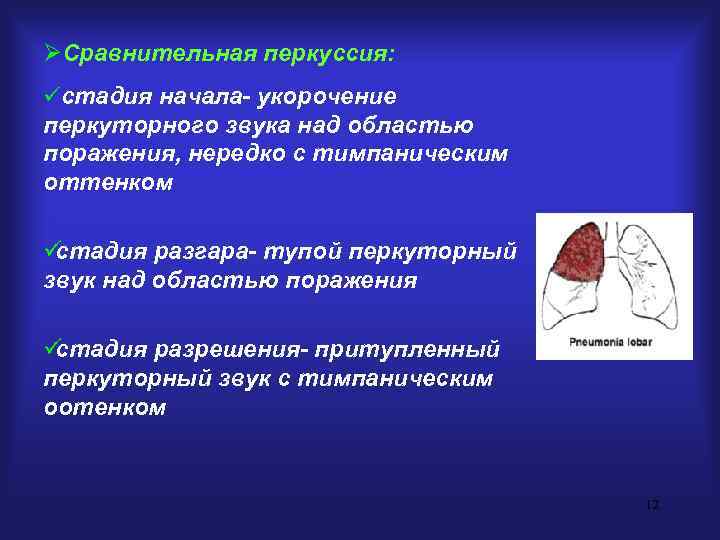 ØСравнительная перкуссия: üстадия начала- укорочение перкуторного звука над областью поражения, нередко с тимпаническим оттенком