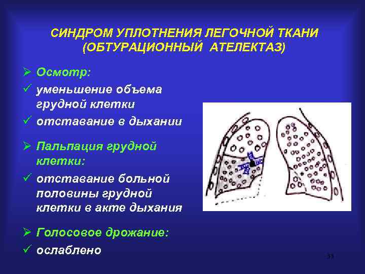   СИНДРОМ УПЛОТНЕНИЯ ЛЕГОЧНОЙ ТКАНИ  (ОБТУРАЦИОННЫЙ АТЕЛЕКТАЗ) Ø Осмотр: ü уменьшение объема