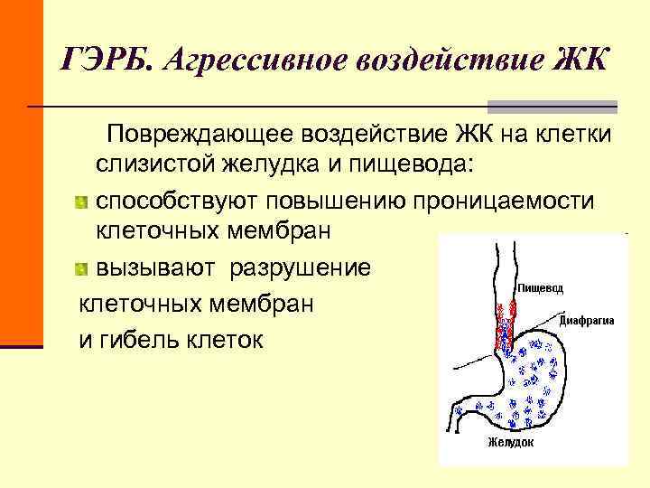 ГЭРБ. Агрессивное воздействие ЖК Повреждающее воздействие ЖК на клетки слизистой желудка и пищевода: ГЭРБ. Агрессивное воздействие ЖК Повреждающее воздействие ЖК на клетки слизистой желудка и пищевода:
