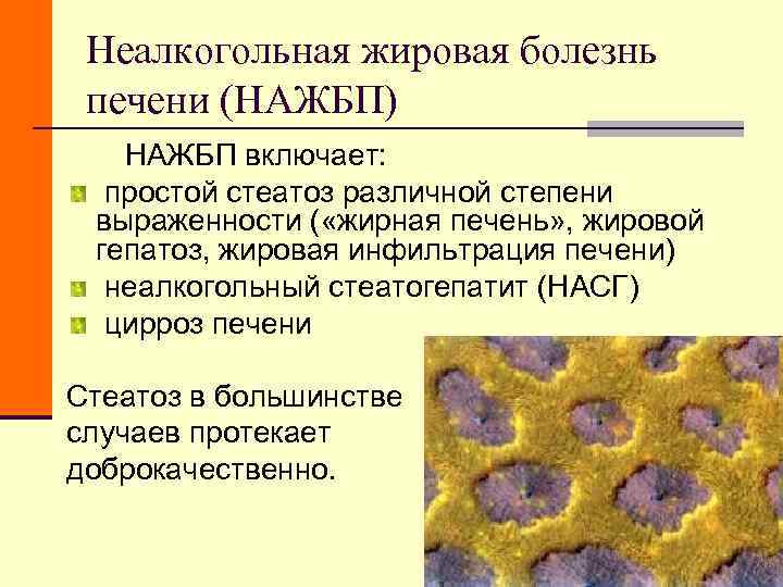 Неалкогольная жировая болезнь печени (НАЖБП) НАЖБП включает: простой Неалкогольная жировая болезнь печени (НАЖБП) НАЖБП включает: простой