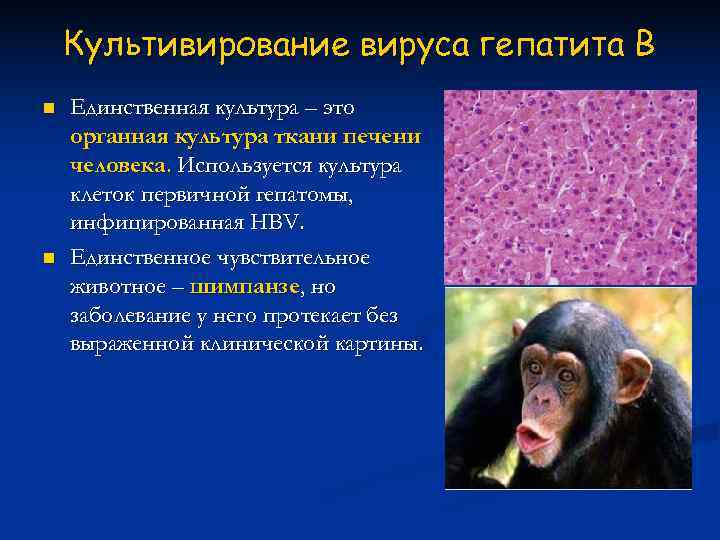   Культивирование вируса гепатита В n  Единственная культура – это органная культура