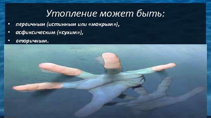   Утопление может быть:  • первичным (истинным или «мокрым» ),  •