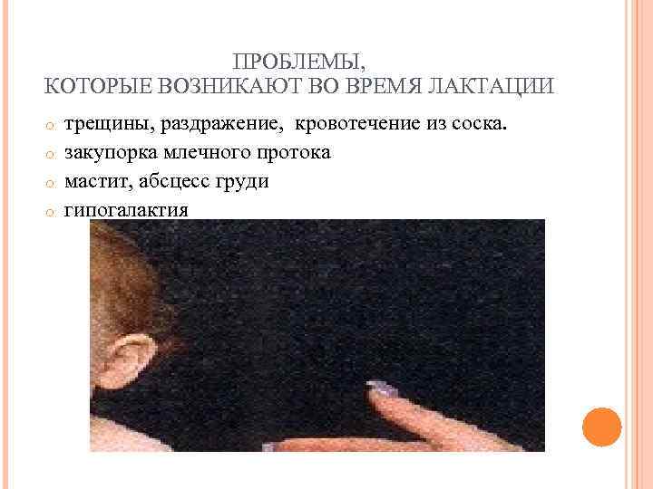   ПРОБЛЕМЫ, КОТОРЫЕ ВОЗНИКАЮТ ВО ВРЕМЯ ЛАКТАЦИИ o  трещины, раздражение, кровотечение