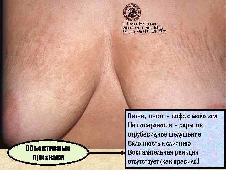    Пятна, цвета – кофе с молоком    На поверхности