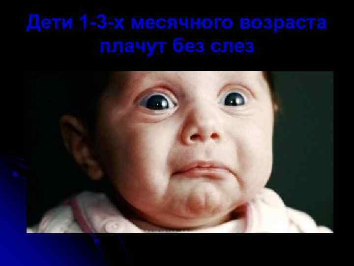 Дети 1 -3 -х месячного возраста  плачут без слез 