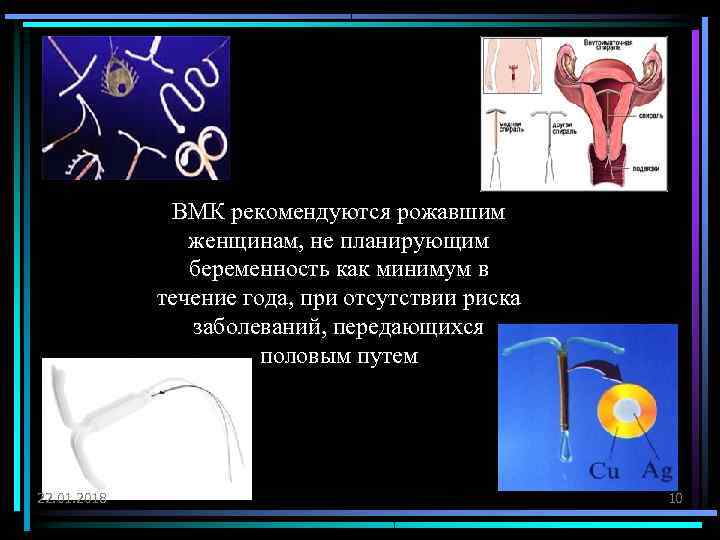    ВМК рекомендуются рожавшим   женщинам, не планирующим   беременность