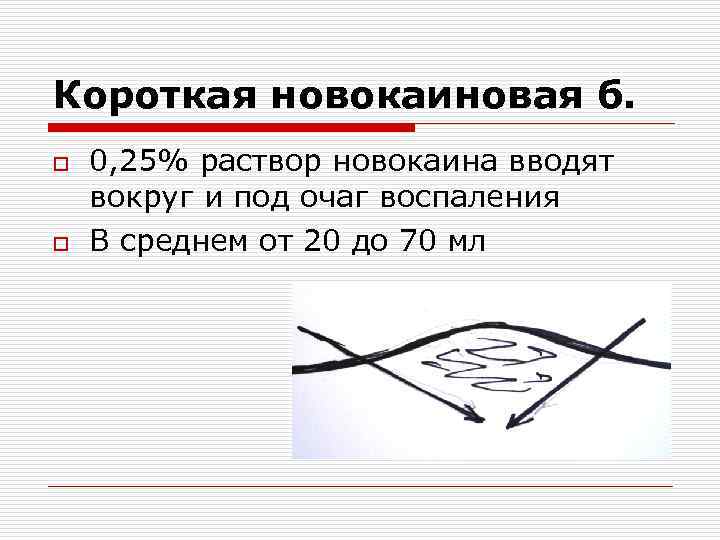 Короткая новокаиновая б. o  0, 25% раствор новокаина вводят вокруг и под очаг