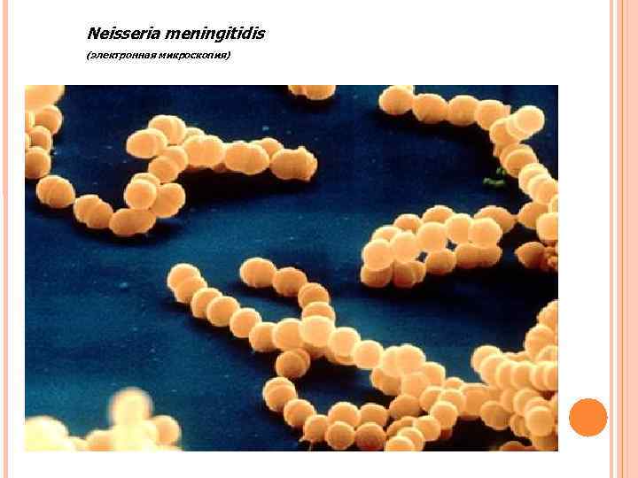 Neisseria meningitidis (электронная микроскопия) Neisseria meningitidis (электронная микроскопия)