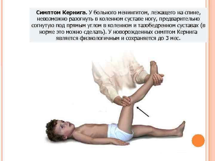 Симптом Кернига. У больного менингитом, лежащего на спине, невозможно разогнуть в коленном суставе Симптом Кернига. У больного менингитом, лежащего на спине, невозможно разогнуть в коленном суставе