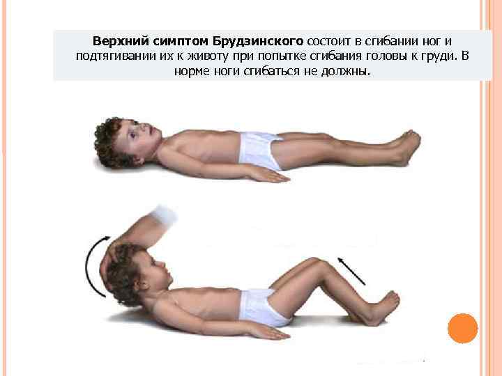 Верхний симптом Брудзинского состоит в сгибании ног и подтягивании их к животу при Верхний симптом Брудзинского состоит в сгибании ног и подтягивании их к животу при