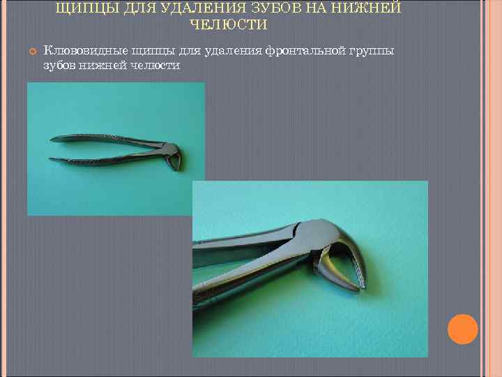  ЩИПЦЫ ДЛЯ УДАЛЕНИЯ ЗУБОВ НА НИЖНЕЙ    ЧЕЛЮСТИ Клювовидные щипцы для