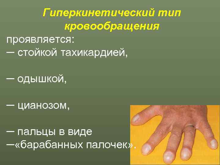  Гиперкинетический тип  кровообращения проявляется:  ─ стойкой тахикардией,  ─ одышкой, 