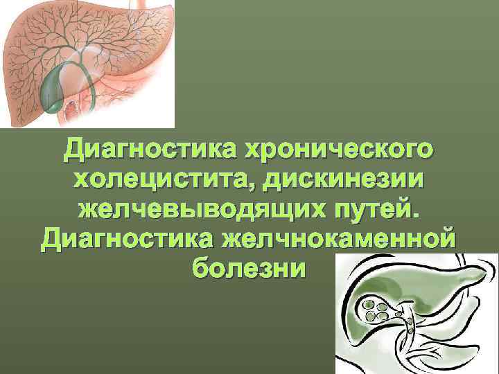  Диагностика хронического  холецистита, дискинезии  желчевыводящих путей. Диагностика желчнокаменной  болезни 