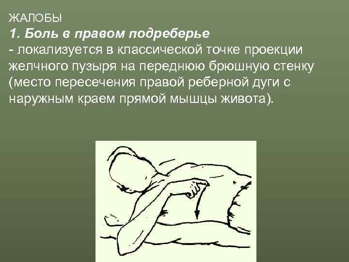 ЖАЛОБЫ 1. Боль в правом подреберье - локализуется в классической точке проекции желчного пузыря