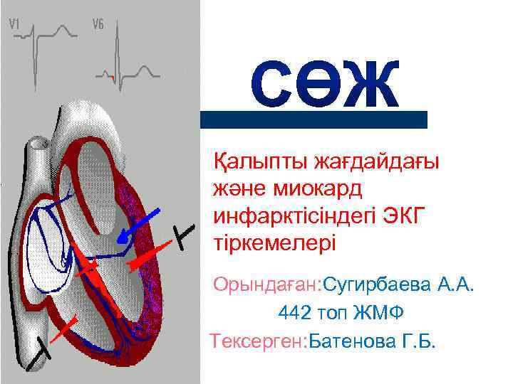 Қалыпты жағдайдағы және миокард инфарктісіндегі ЭКГ тіркемелері Орындаған: Сугирбаева А. А.   442