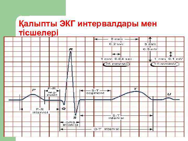 Қалыпты ЭКГ интервалдары мен тісшелері 