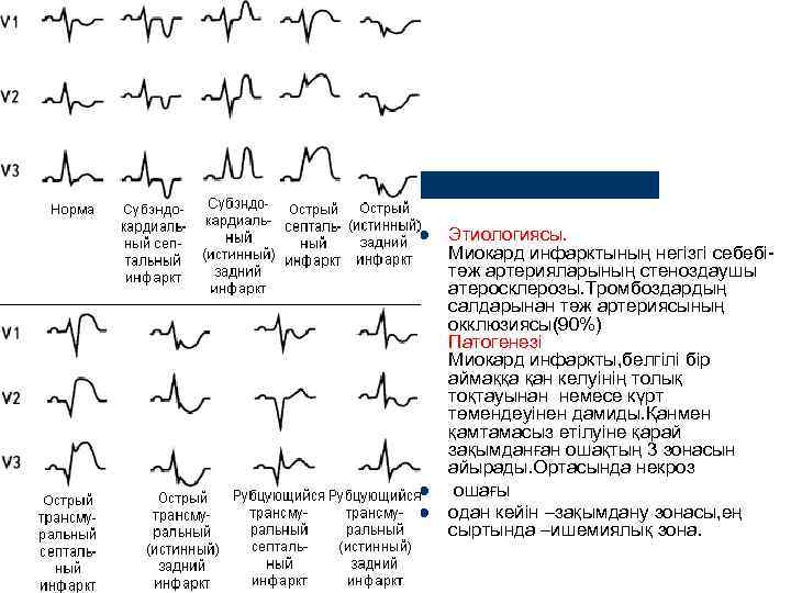 l  Этиологиясы. Миокард инфарктының негізгі себебі- тәж артерияларының стеноздаушы атеросклерозы. Тромбоздардың салдарынан тәж