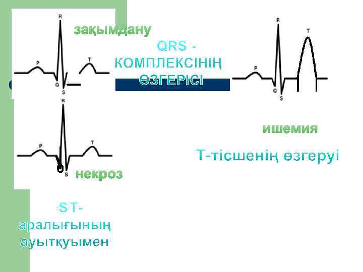 зақымдану   ишемия  некроз 
