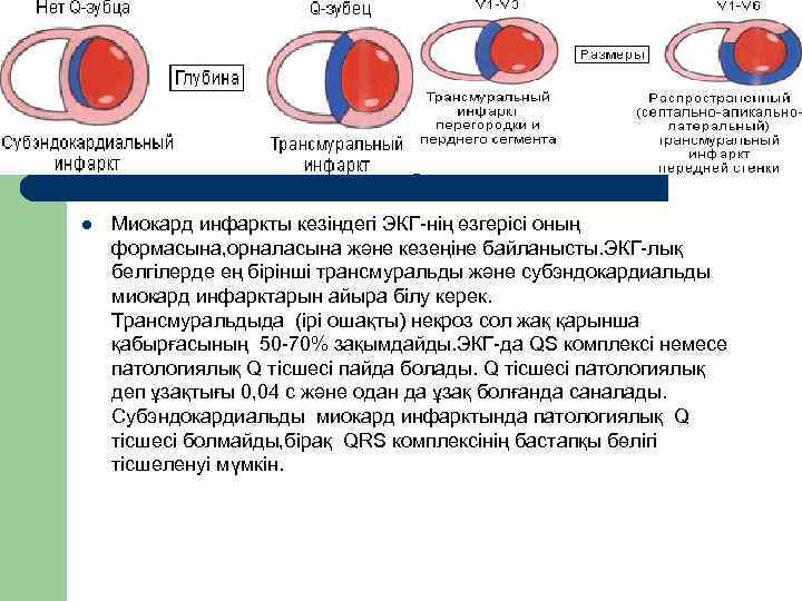 l  Миокард инфаркты кезіндегі ЭКГ-нің өзгерісі оның формасына, орналасына және кезеңіне байланысты. ЭКГ-лық