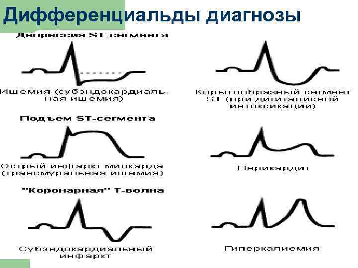 Дифференциальды диагнозы 