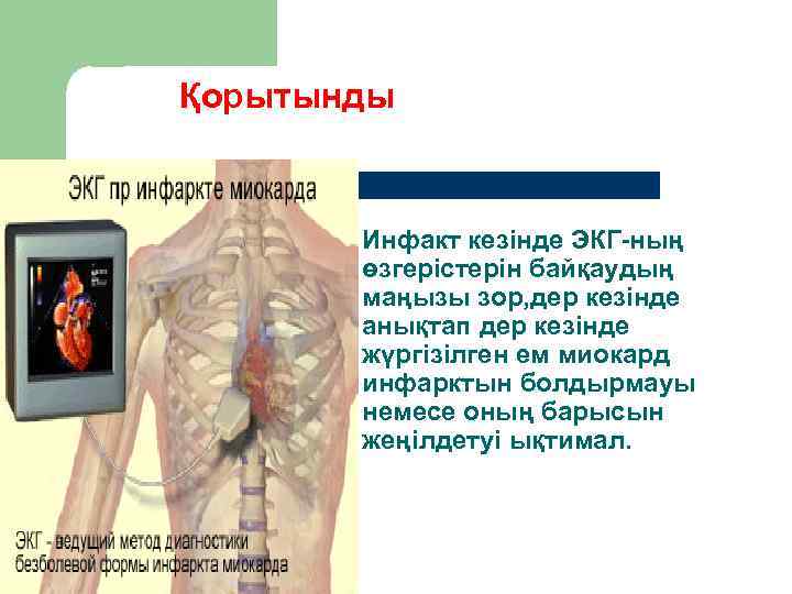 Қорытынды   Инфакт кезінде ЭКГ-ның  өзгерістерін байқаудың  маңызы зор, дер кезінде