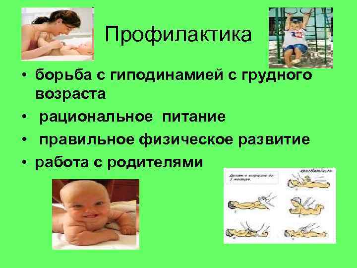    Профилактика • борьба с гиподинамией с грудного  возраста • рациональное