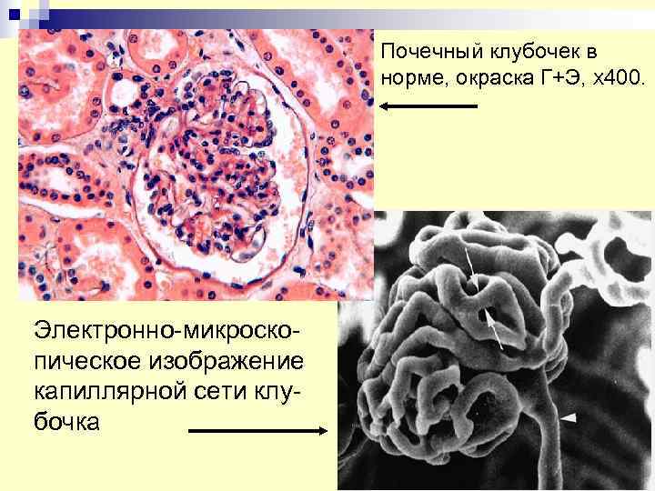 Почечный клубочек. Клубочки почек. Почечные клубочки в норме. Анатомия почечного клубочка.