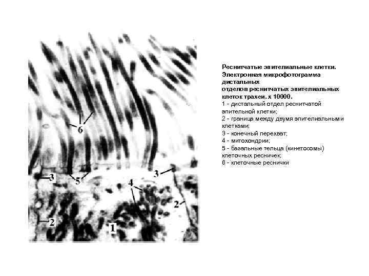 Реснитчатые эпителиальные клетки. Электронная микрофотограмма дистальных отделов реснитчатых эпителиальных клеток трахеи. х 10000. 1